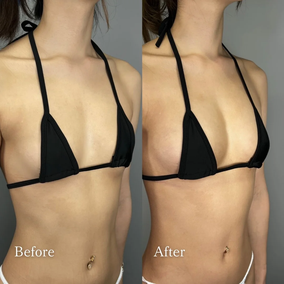 Before After