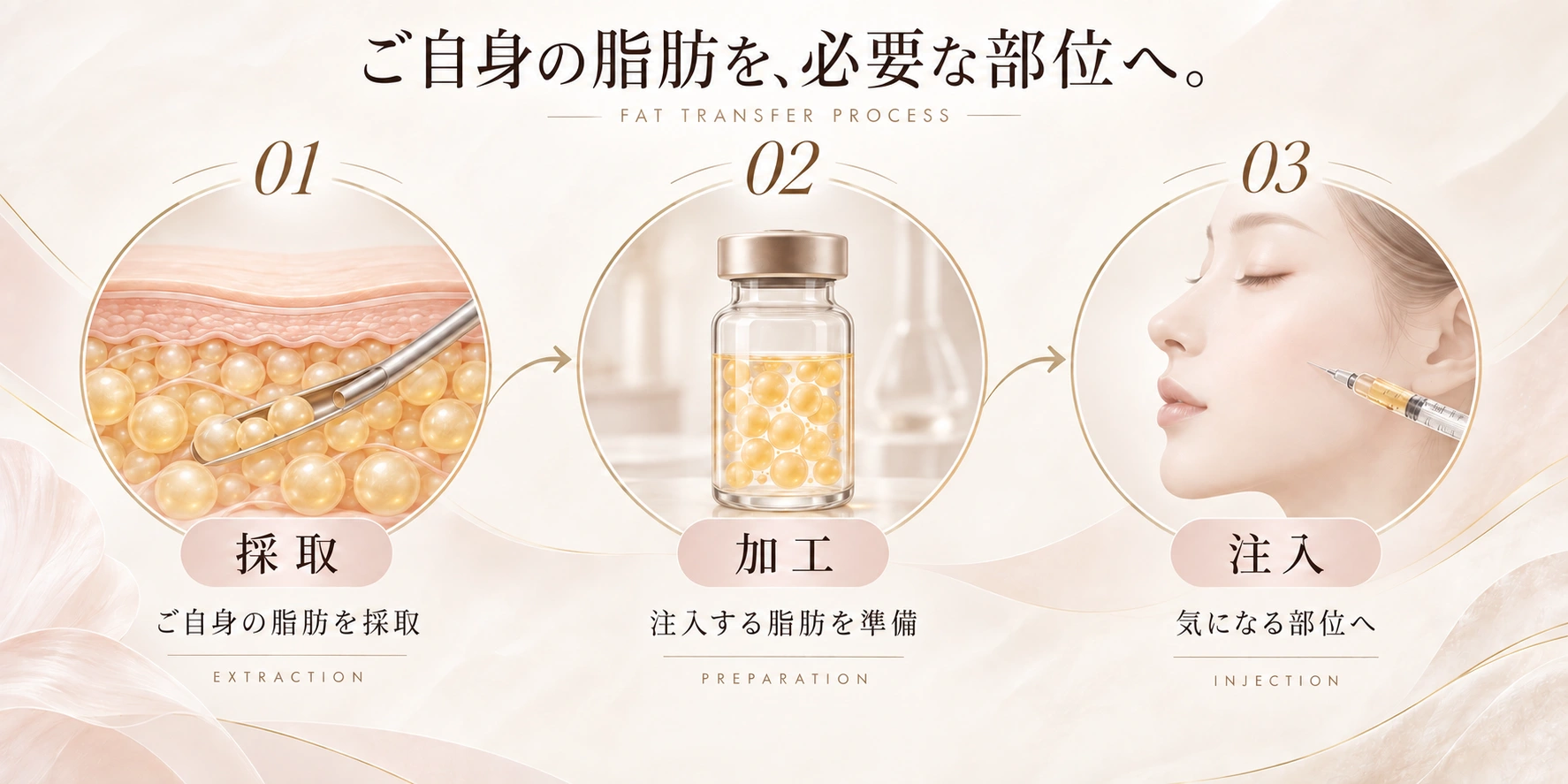 ご自身の脂肪を必要な部位へ。01 採取:ご自身の脂肪を採取。02 加工:注入する脂肪を準備。03 注入:気になる部位へ。